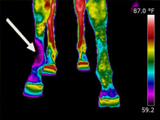 nerve-damage